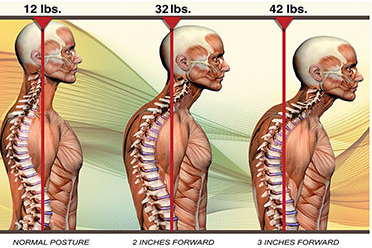 How to Fix Tech Neck From Working at a Desk in 2026